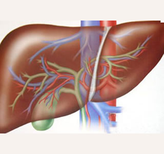 脾功能亢進(jìn)