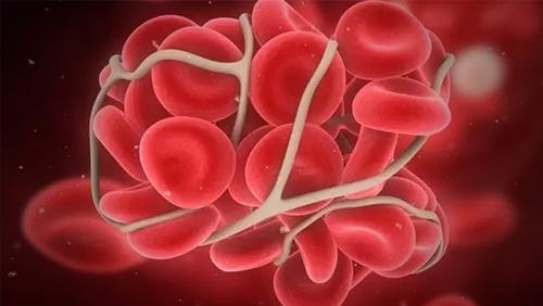 原發(fā)性血小板增多癥