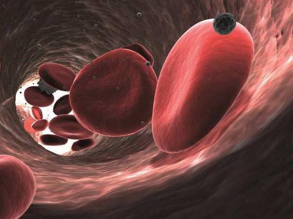 多發(fā)性骨髓瘤