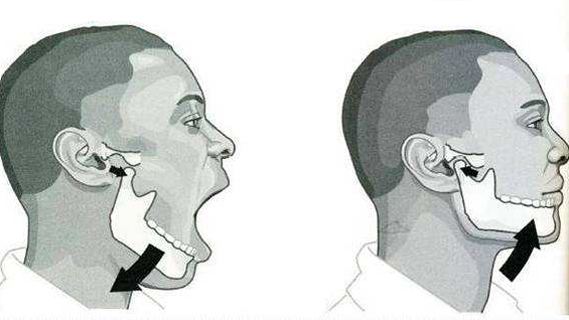 顳下頜關(guān)節(jié)脫位