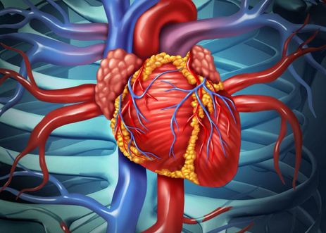 心臟粘液瘤