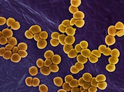 大皰性表皮松解癥