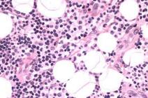 小兒腸系淋巴炎