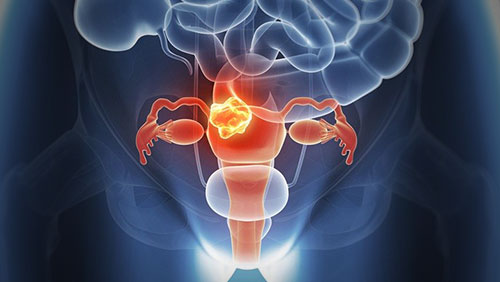 功能性子宮出血